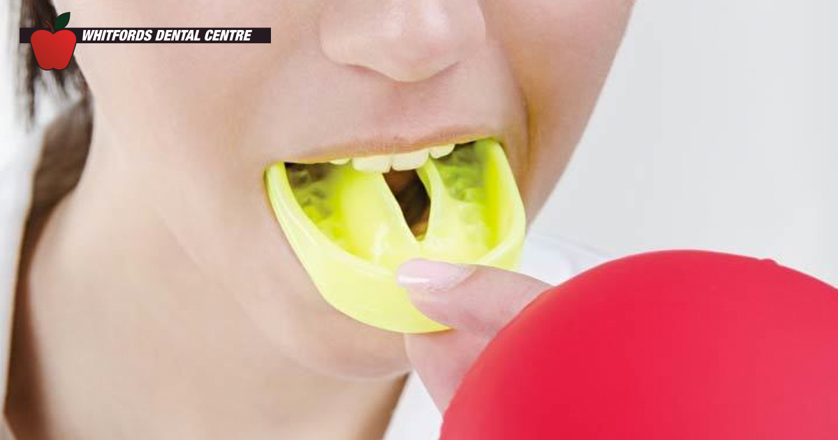 CustomFit Mouthguards For Your Active Lifestyle